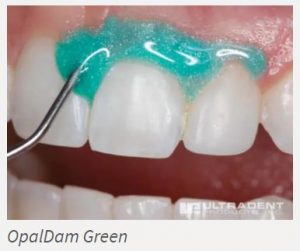 OpalDam Green Gum Barrier